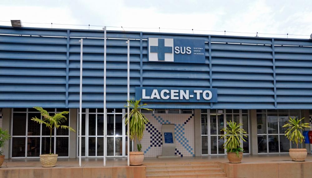 SES-TO segue com a distribuição de testes RT-PCR