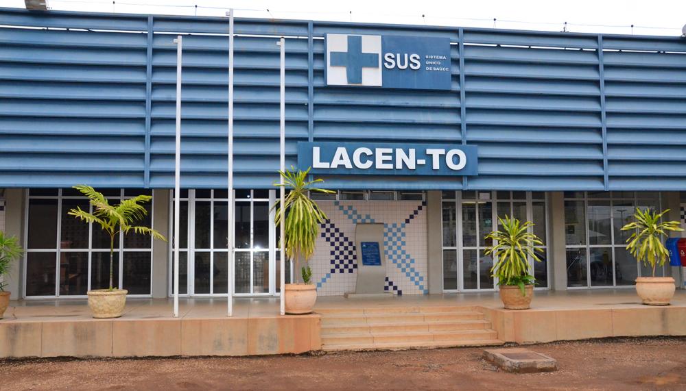 Os exames são ofertados pelo SUS e são realizados pelo Laboratório Central do Estado, nas unidades de Palmas e Araguaína 