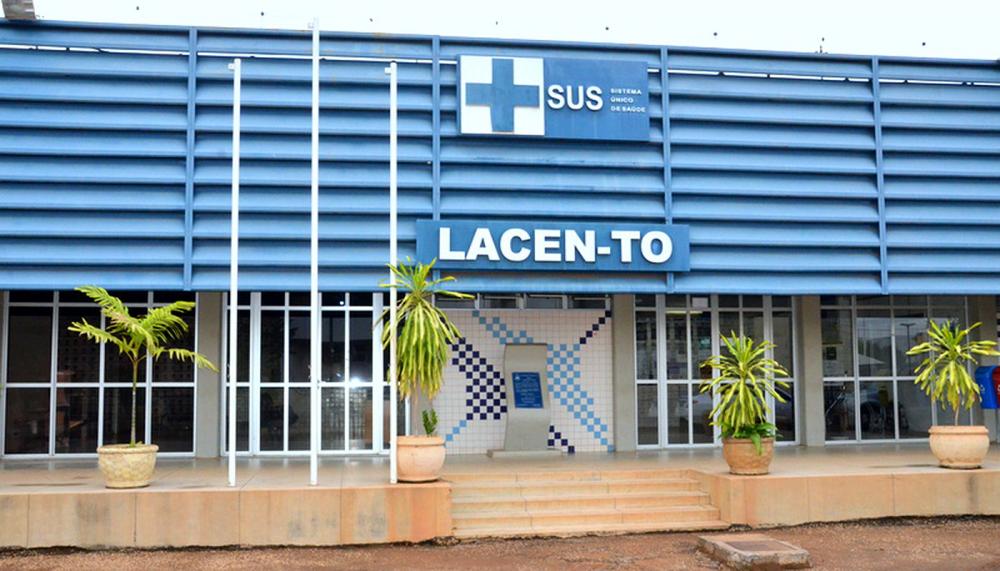 Unidades do laboratório em Palmas e Araguaína estarão funcionando normalmente 