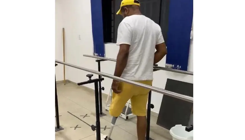  No total, serão realizadas sete medidas e nove entregas de próteses