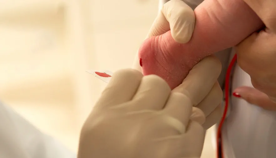 Teste do Pezinho é a primeira triagem de fibrose cística na infância