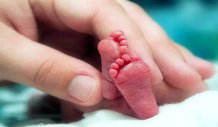 Campanha Novembro Roxo de Prevenção à Prematuridade é realizada com objetivo de ampliar iniciativas voltadas ao cuidado de gestantes e recém-nascidos atendidos no SUS .