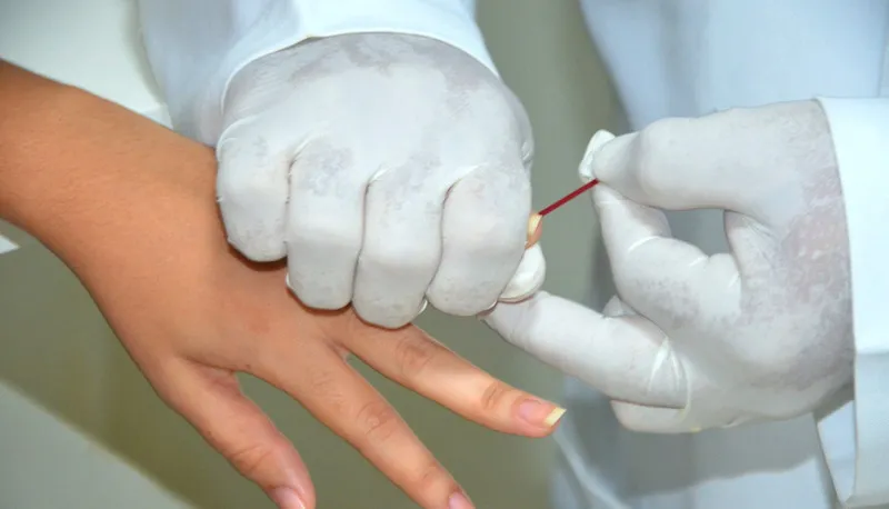 Entre janeiro e outubro deste ano, o Tocantins já registrou 356 casos de HIV e 68 de Aids.